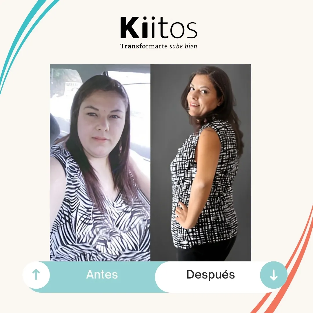 Fotografías de antes y después compartidas por la comunidad Kiitos 21