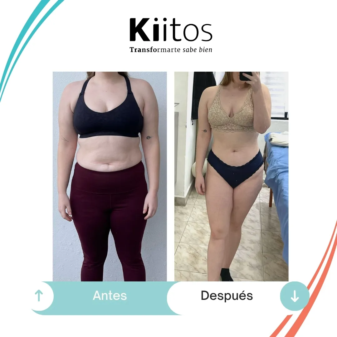 Fotografías de antes y después compartidas por la comunidad Kiitos 59